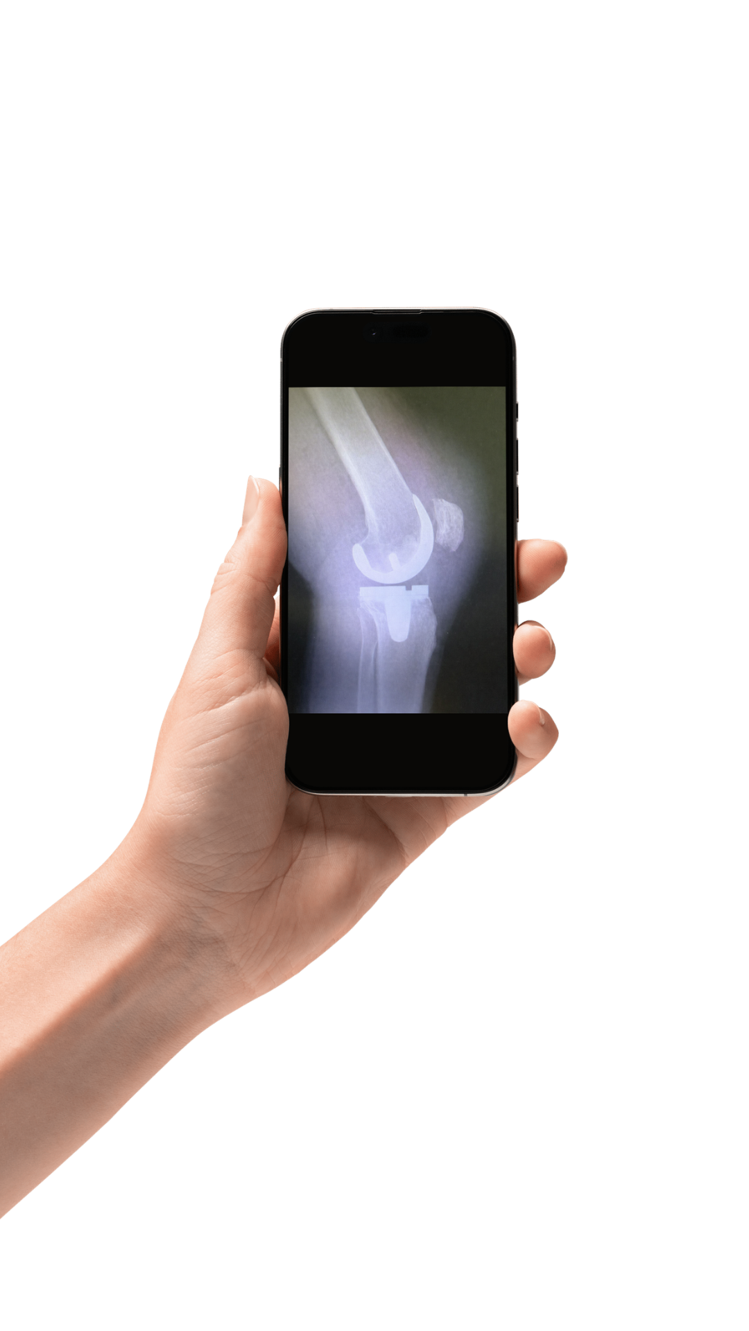 kne-radiologisk-bilde